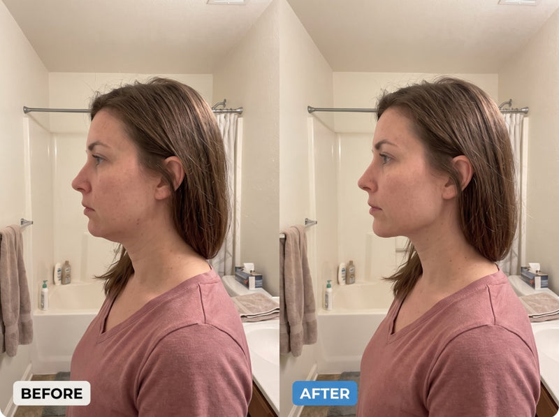 My jawline looks noticeably sharper after just 3 weeks.